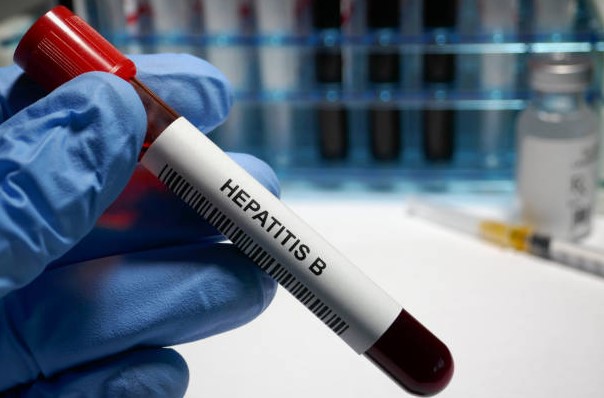 Hepatitis B & C: These Silent Liver Infections Hepatitis B & C